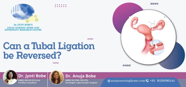 Can a Tubal Ligation be Reversed
