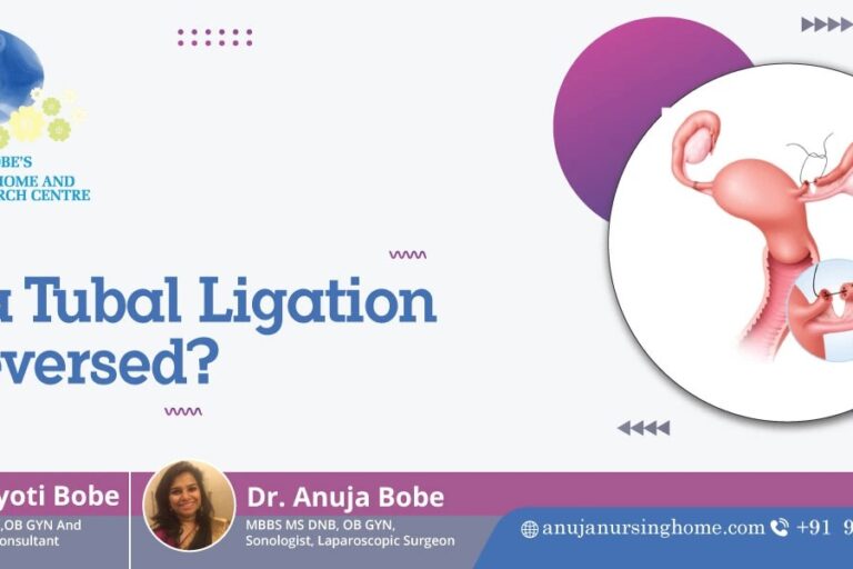 Can a Tubal Ligation be Reversed