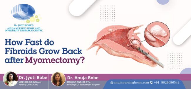 How Fast do Fibroids Grow Back after Myomectomy