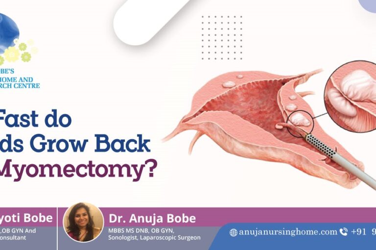 How Fast do Fibroids Grow Back after Myomectomy