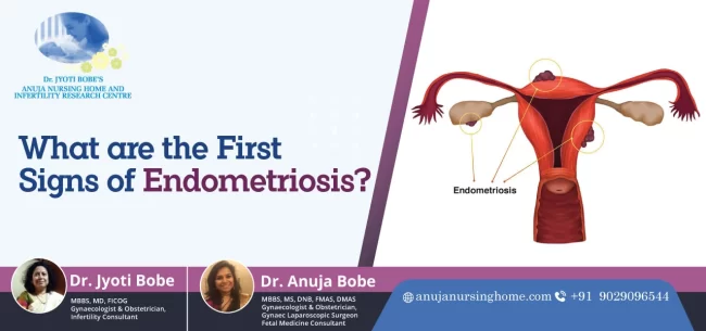 What are the First Signs of Endometriosis