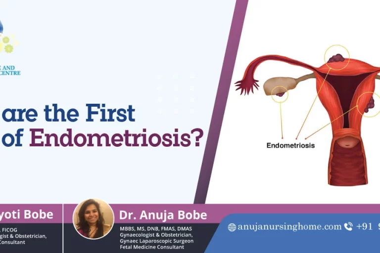 What are the First Signs of Endometriosis