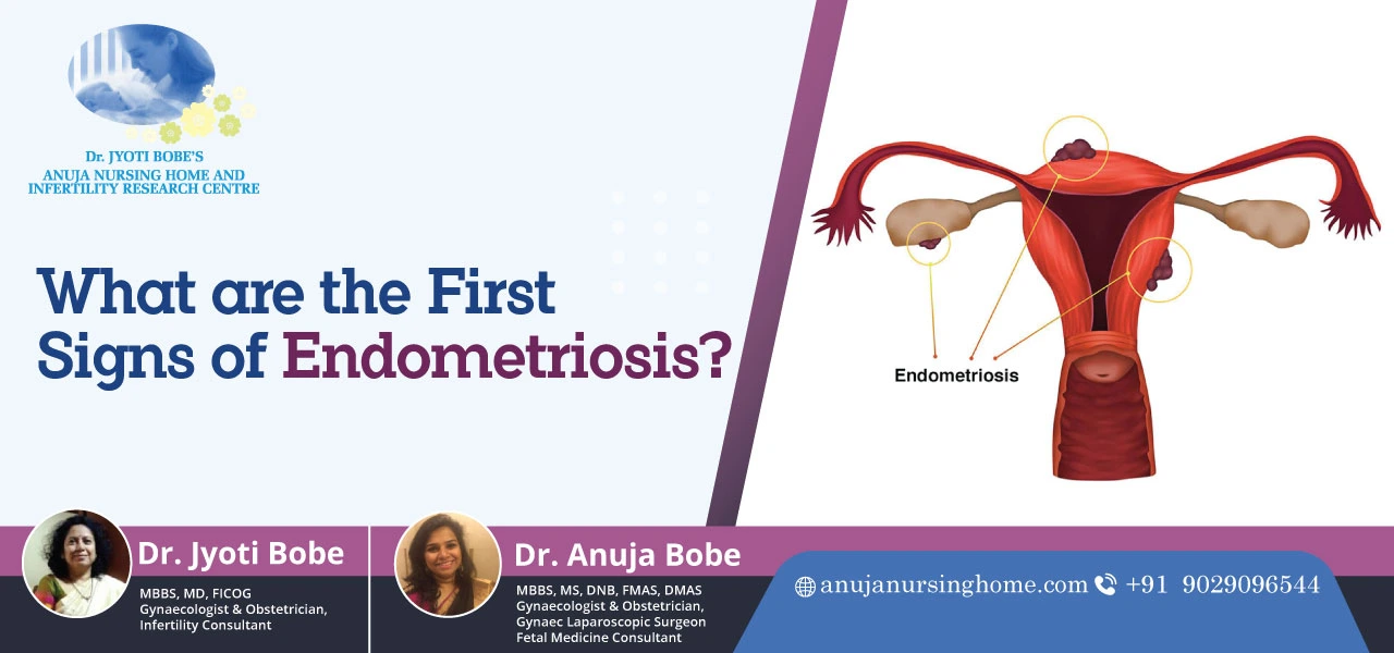 What are the First Signs of Endometriosis
