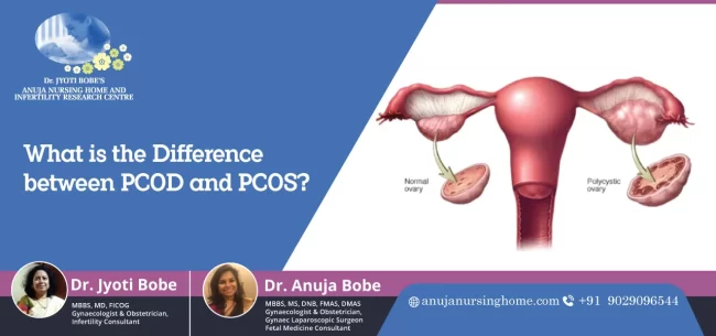What is the Difference between PCOD and PCOS