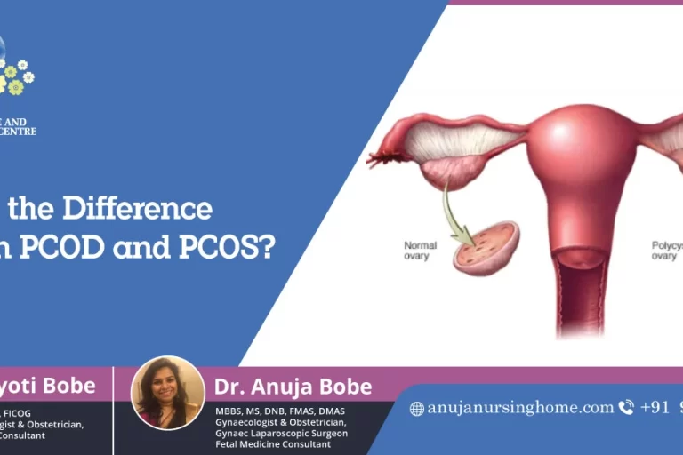 What is the Difference between PCOD and PCOS