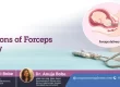 Indications of Forceps Delivery