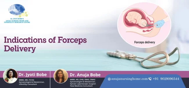 Indications of Forceps Delivery