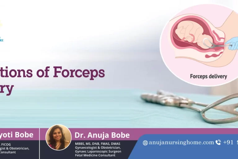 Indications of Forceps Delivery
