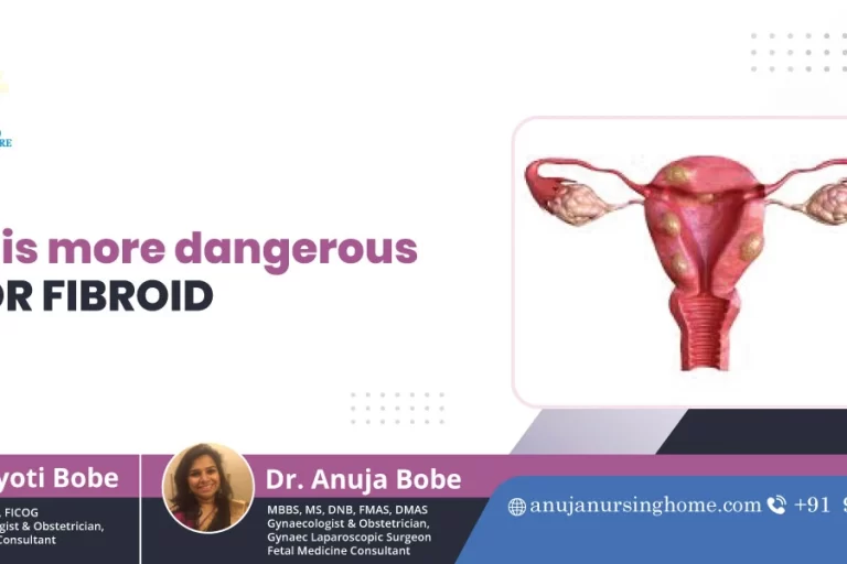 Which is More Dangerous, a Cyst or a Fibroid