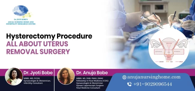 hysterectomy: procedure: all you should know