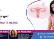 PCOS Changed to PMOS? Here’s What It Means
